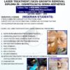 Course 105: Laser Treatment / Skin Growth Removal